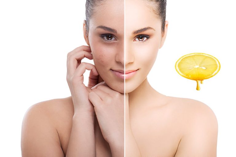 Remove Dark Spots on Face Tang - Lemon Juice